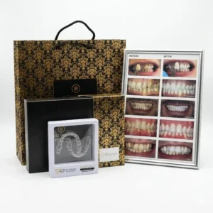 Boutique Whitening Take-Home Kit (16%)